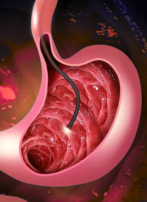 endoscopy proc